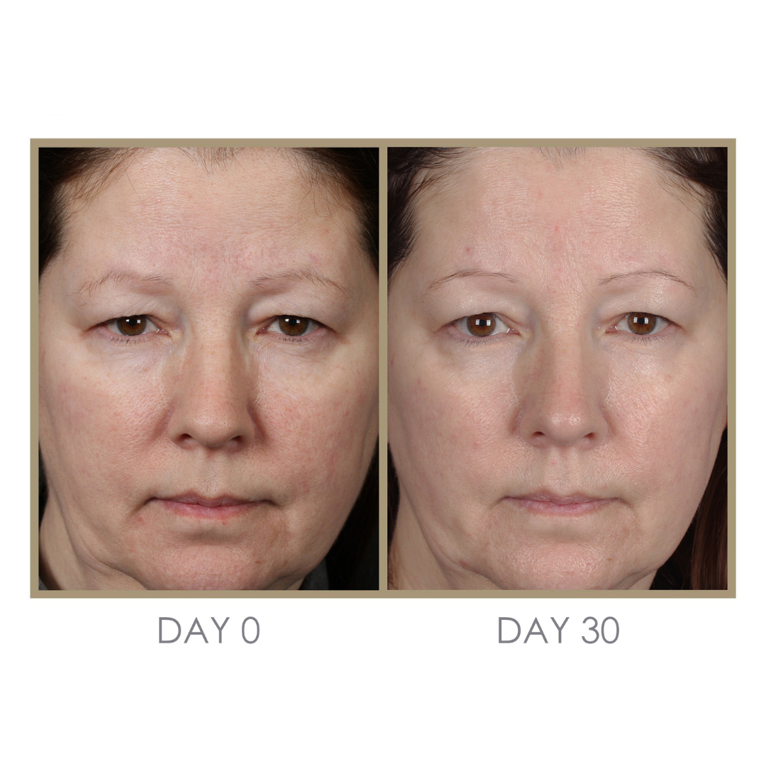 RTS: Dream Cream Moisturizing Treatment by Genie