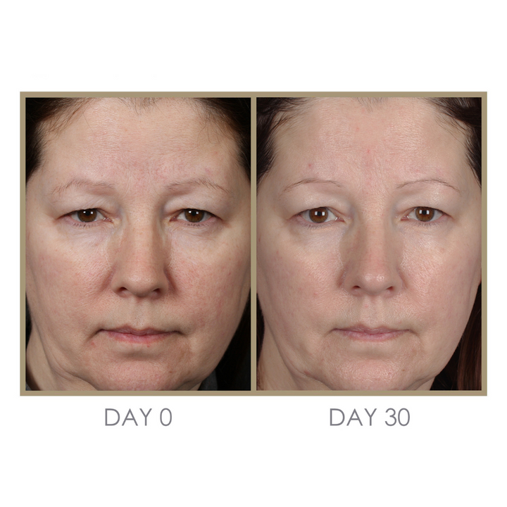 RTS: Dream Cream Moisturizing Treatment by Genie