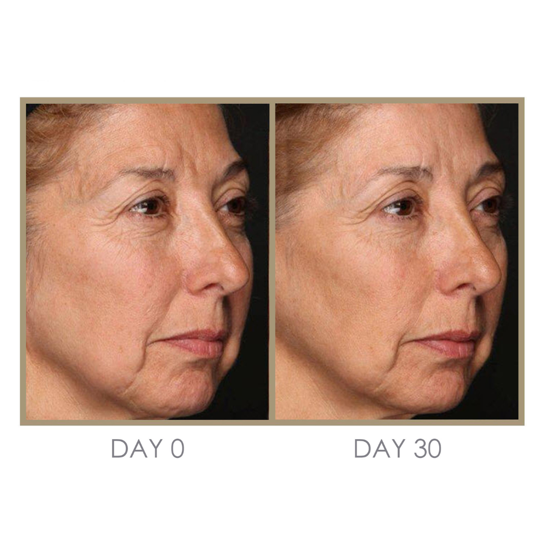 RTS: Dream Cream Moisturizing Treatment by Genie