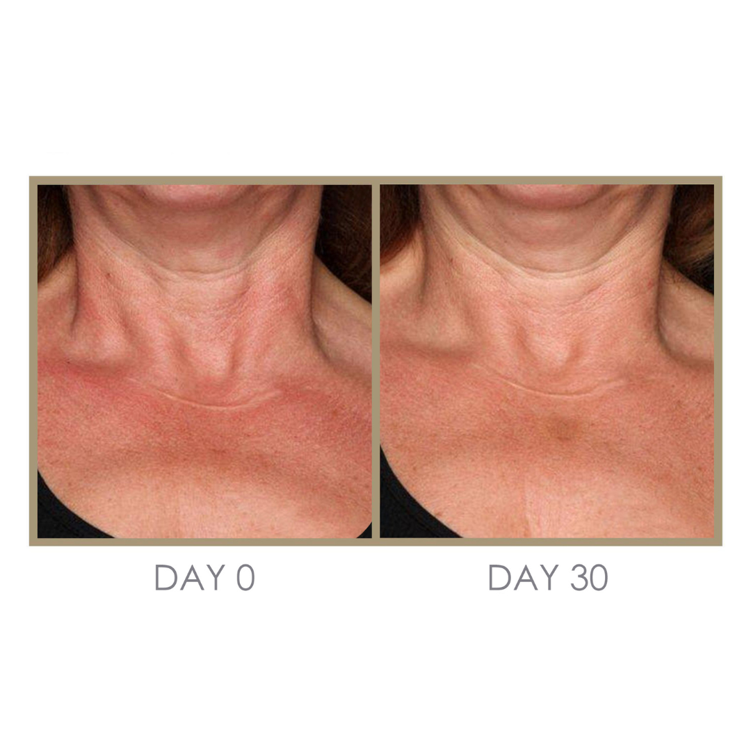 RTS: Dream Cream Moisturizing Treatment by Genie