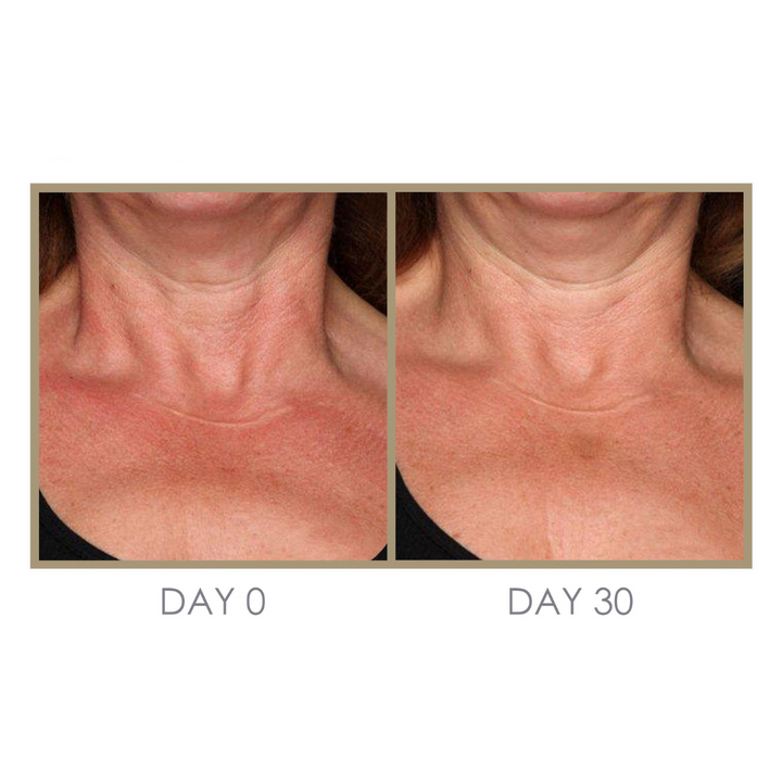 RTS: Dream Cream Moisturizing Treatment by Genie