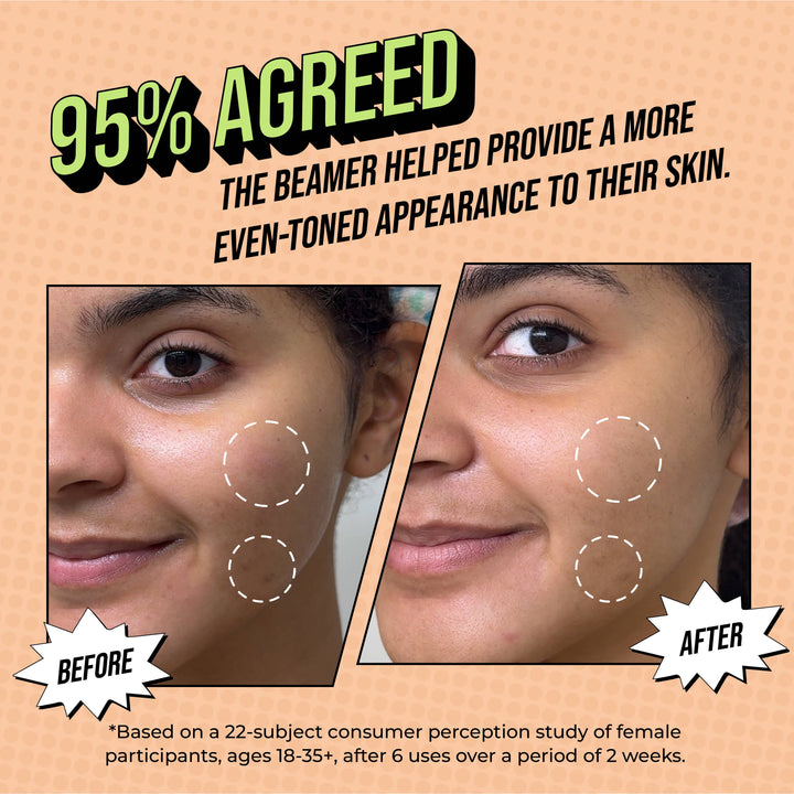 The Beamer Skin Treatment
