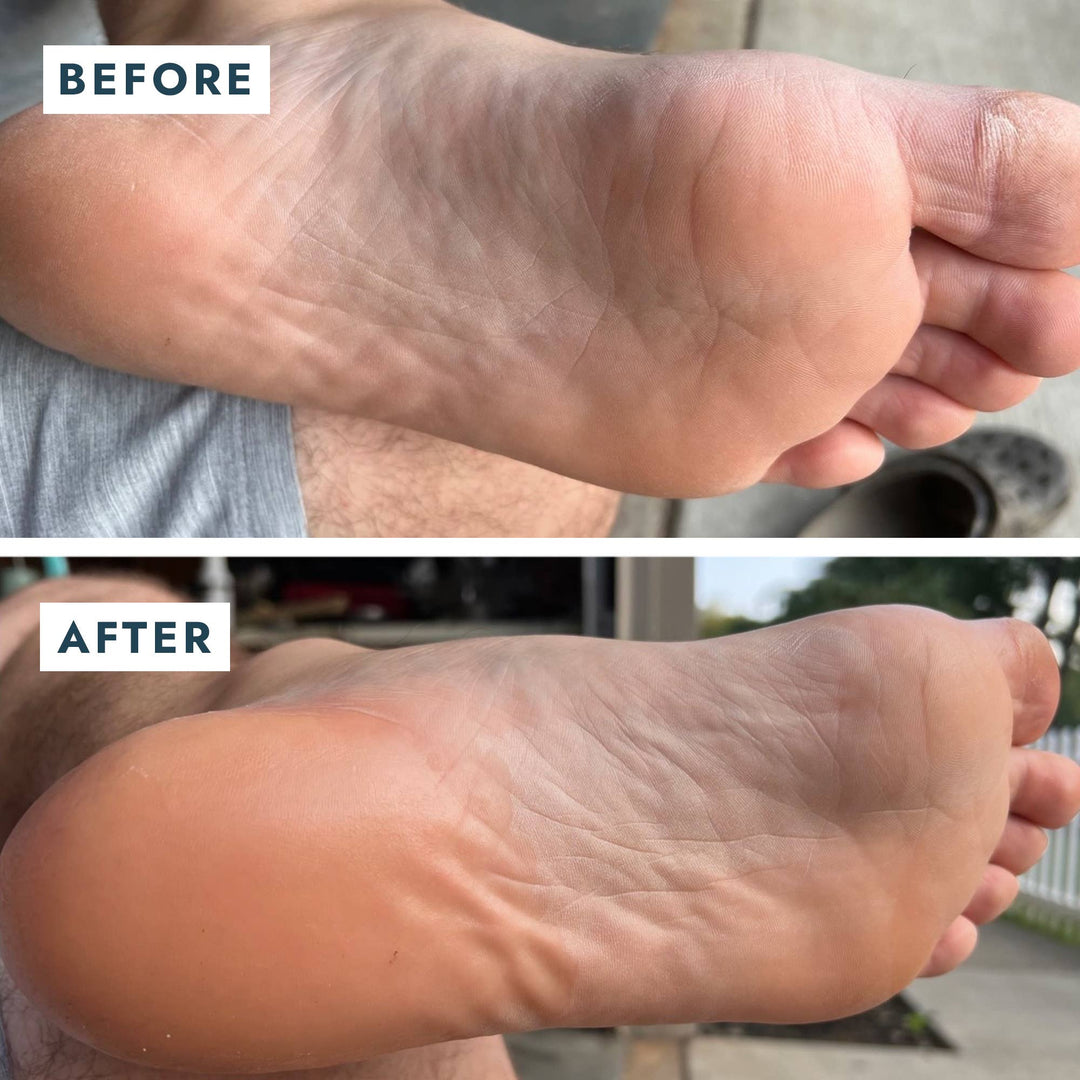 Solemate Heel Repair Balm - Mint