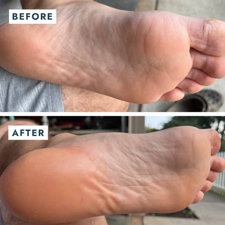 Solemate Heel Repair Balm - Mint