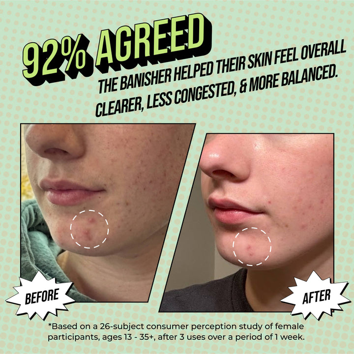 The Banisher Skin Treatment