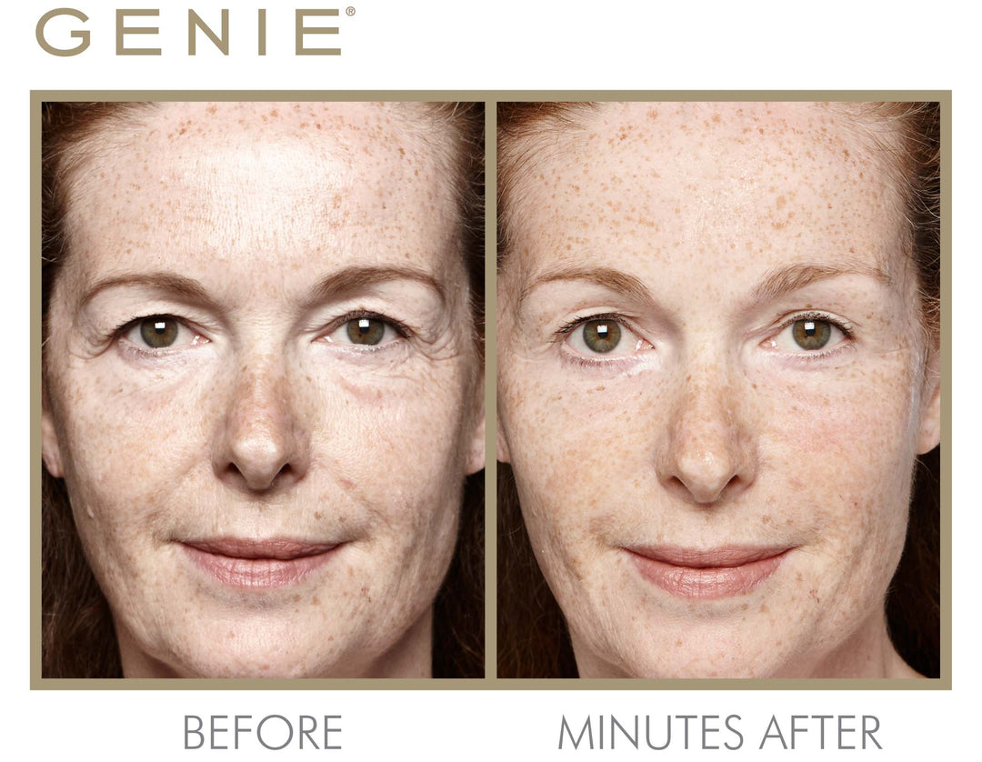 Instant Line Smoother Duo