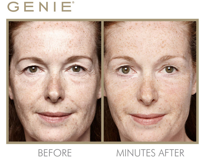 Instant Line Smoother Duo