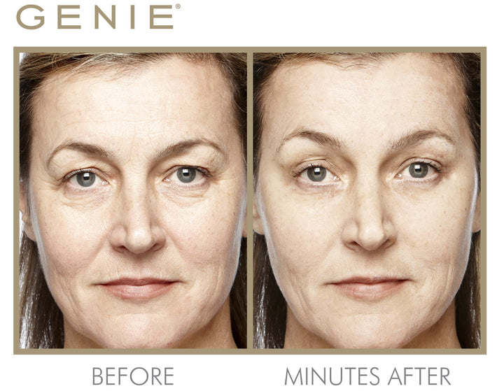 Instant Line Smoother Duo