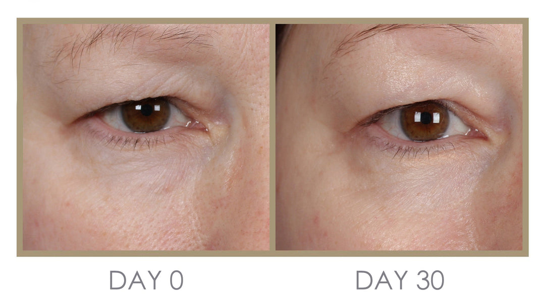 RTS: H'eye'drator Eye Cream by Genie