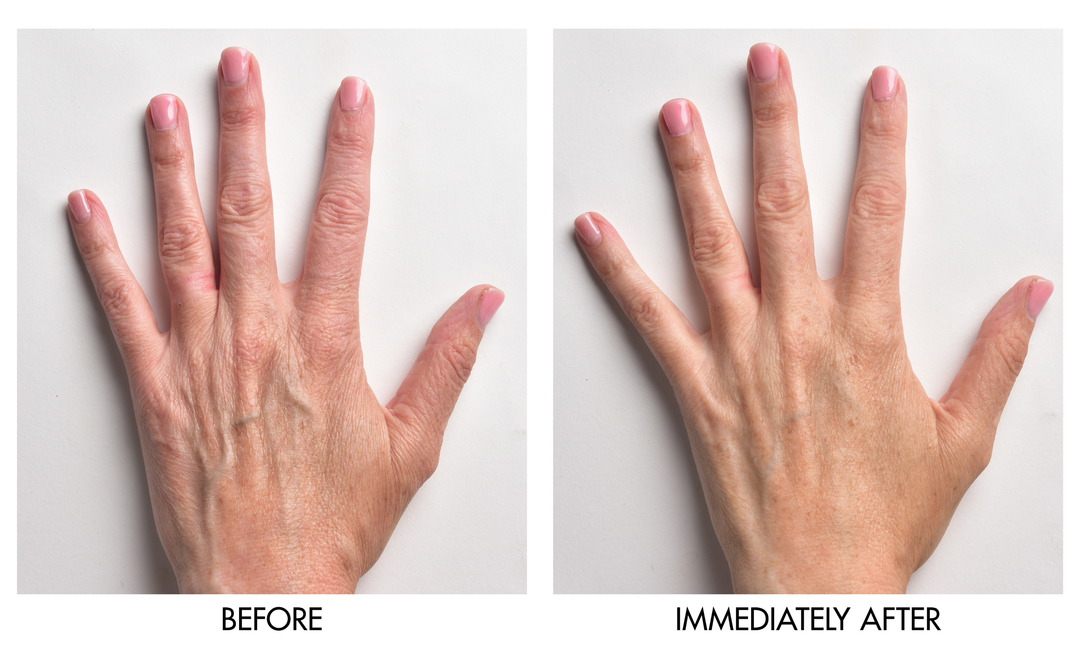 Before and after comparison showing visibly smoother and more even-toned hand skin immediately after applying Genie Instant Hand Perfecter