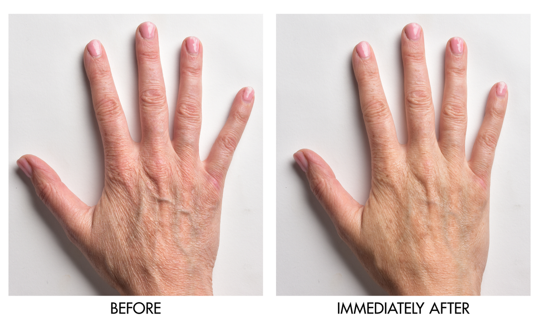 Before and after comparison showing reduced dryness and improved skin smoothness on hand immediately after applying Genie Instant Hand Perfecter