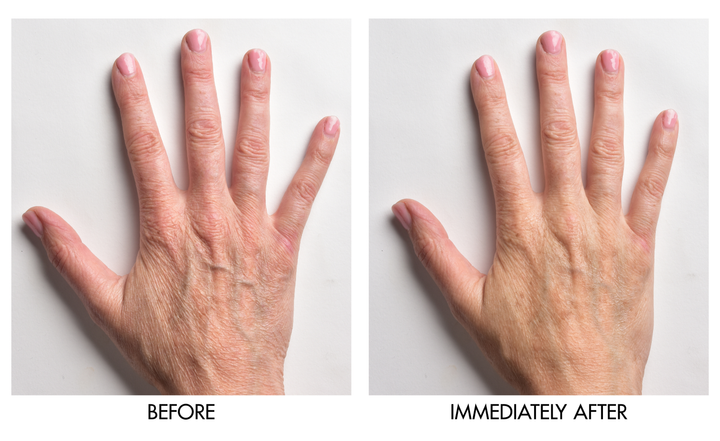 Before and after comparison showing reduced dryness and improved skin smoothness on hand immediately after applying Genie Instant Hand Perfecter