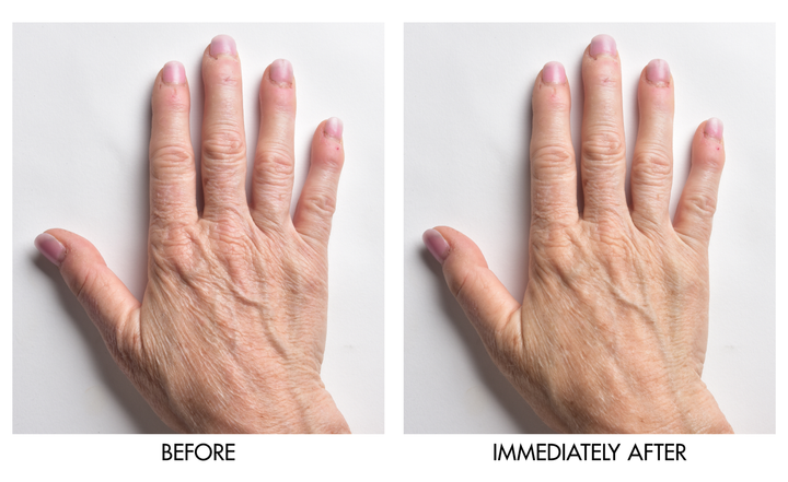 Before and after comparison showing reduced hand wrinkles and smoother skin texture immediately after applying Genie Instant Hand Perfecter