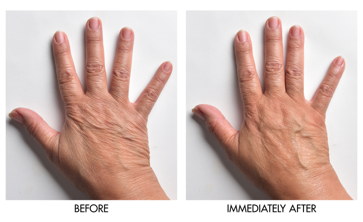 Before and after comparison showing hand skin texture improvement immediately after applying Genie Instant Hand Perfecter